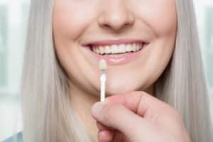 Veneers - Get the Perfect Smile at Ingleside Family Dental